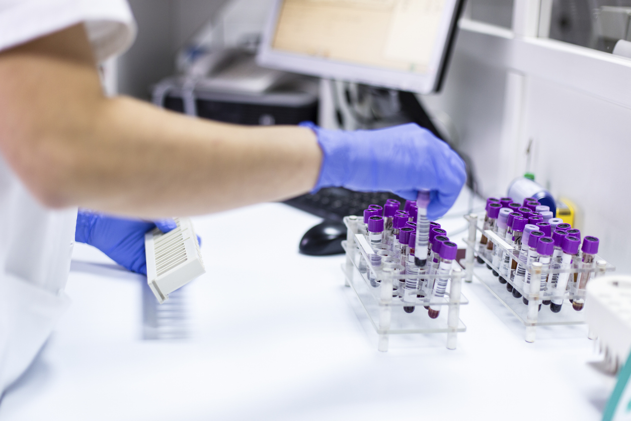 Blood tubes at the microbiology laboratory